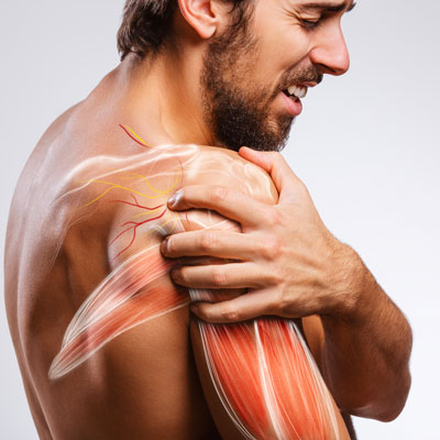 Suffering from Shoulder Impingement?